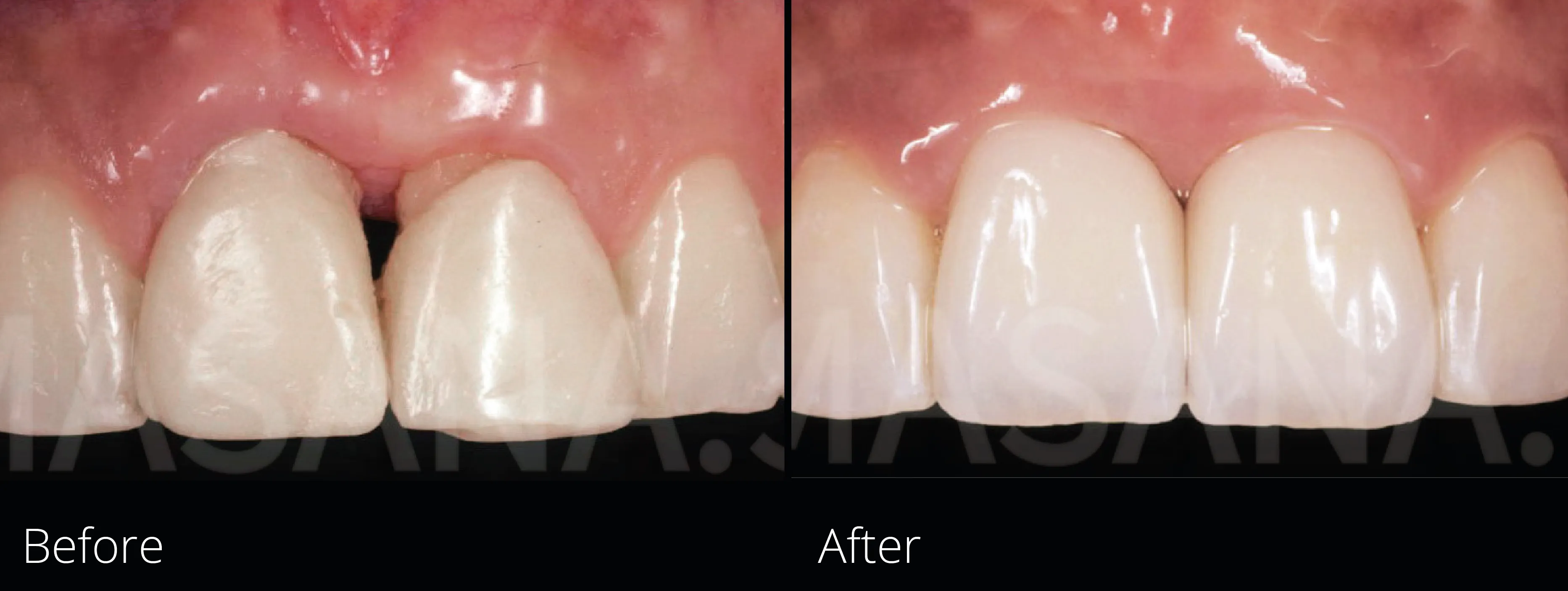 Dynamic Content Image